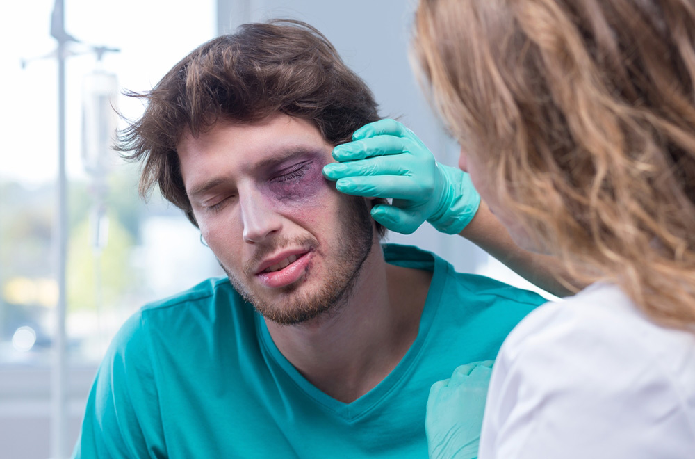 Man being treated for black eye sustained in an assault