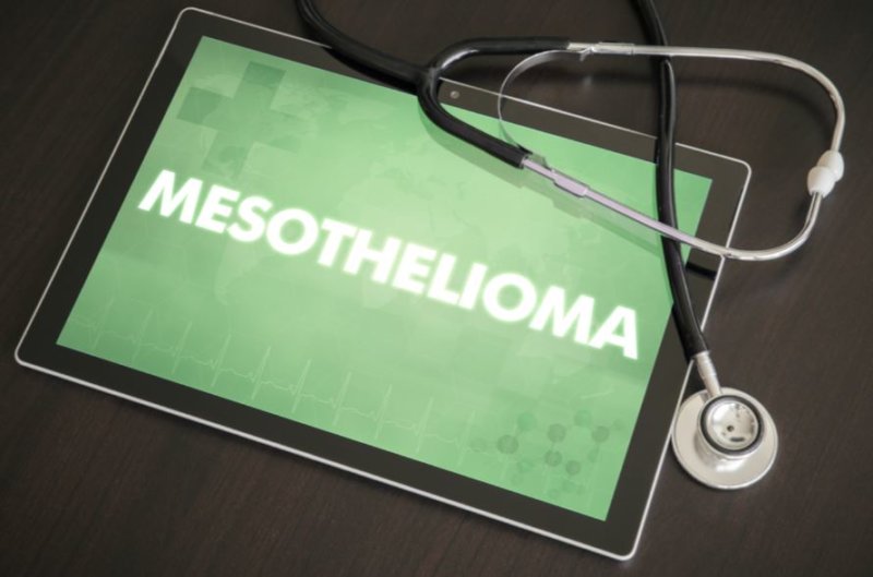 How do you go about making a mesothelioma claim? Mooneerams