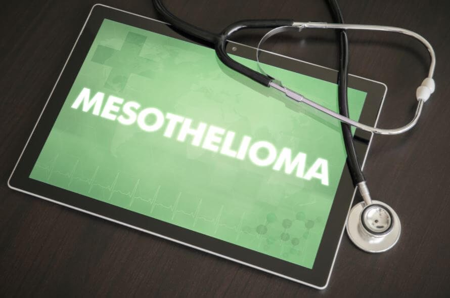 mesothelioma