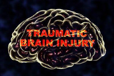 traumatic brain injury