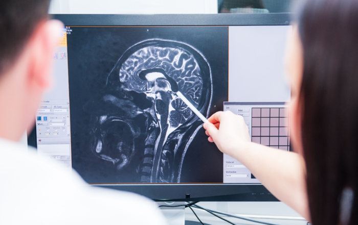 traumatic brain injury