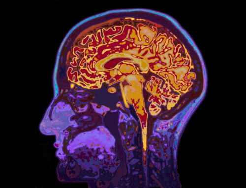 Brain Tumour Delayed Diagnosis: How It Happens and What You Can Do