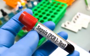 Vial of blood for sepsis test