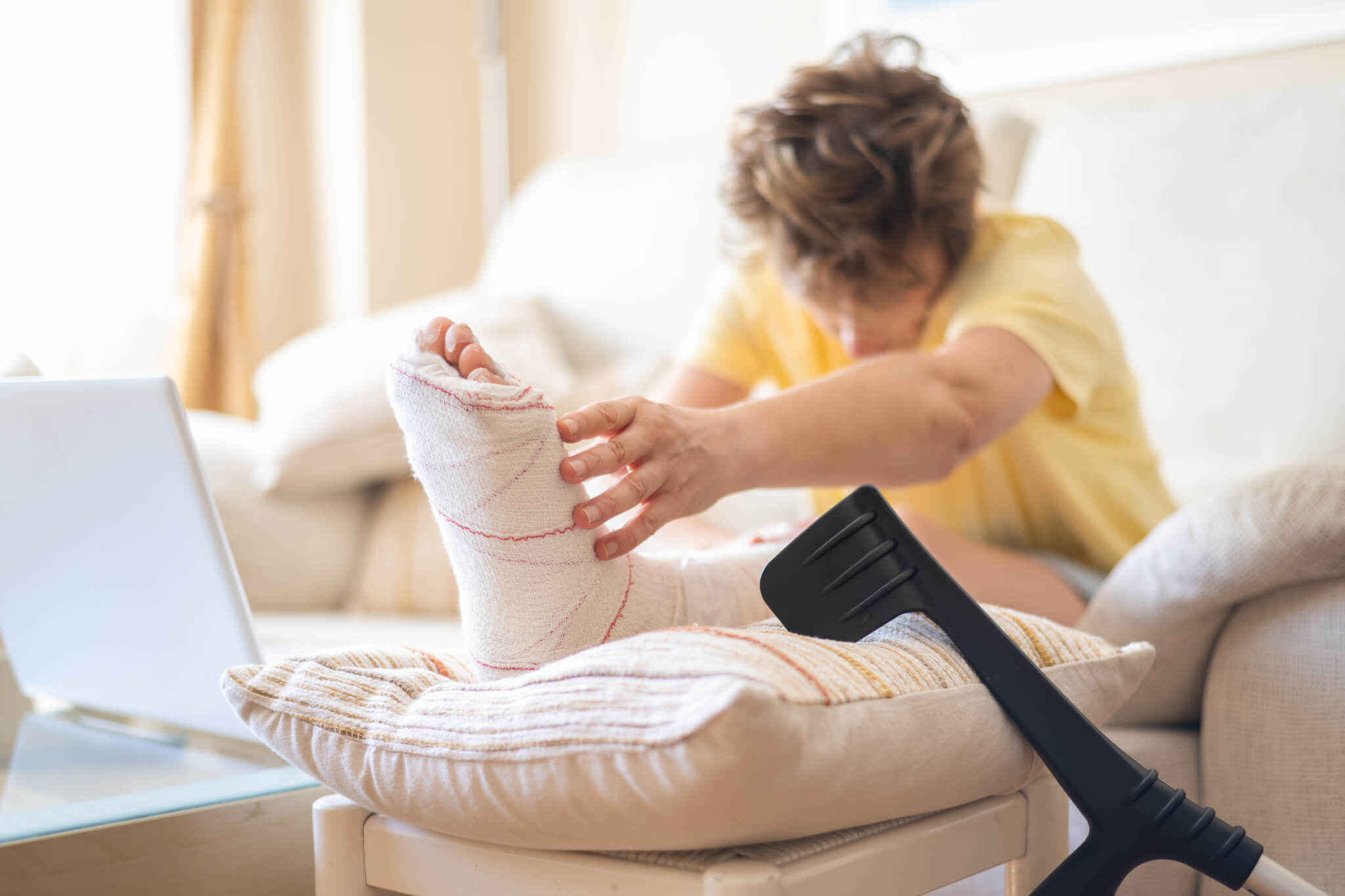 complex fracture – broken bone complex fracture - broken bone