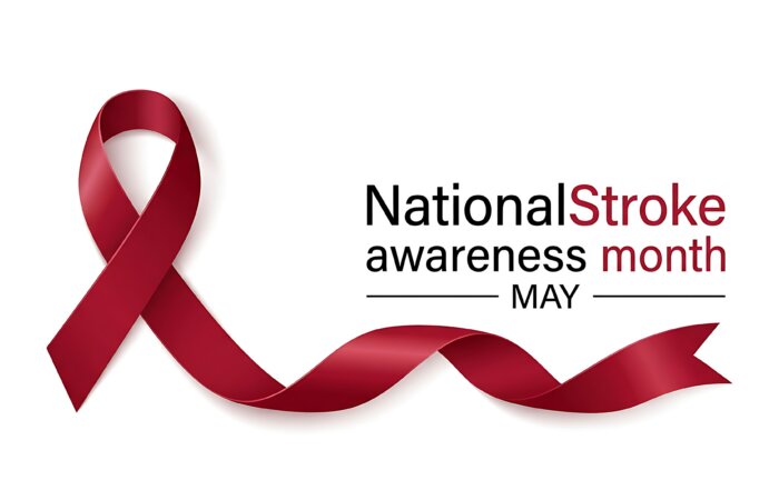 Stroke awareness and medical negligence